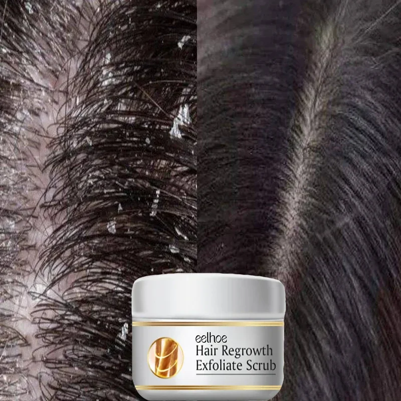 Fast Anti Dandruff Hair Treatm - огляд і ціна Scalp Scrub Exfoliant