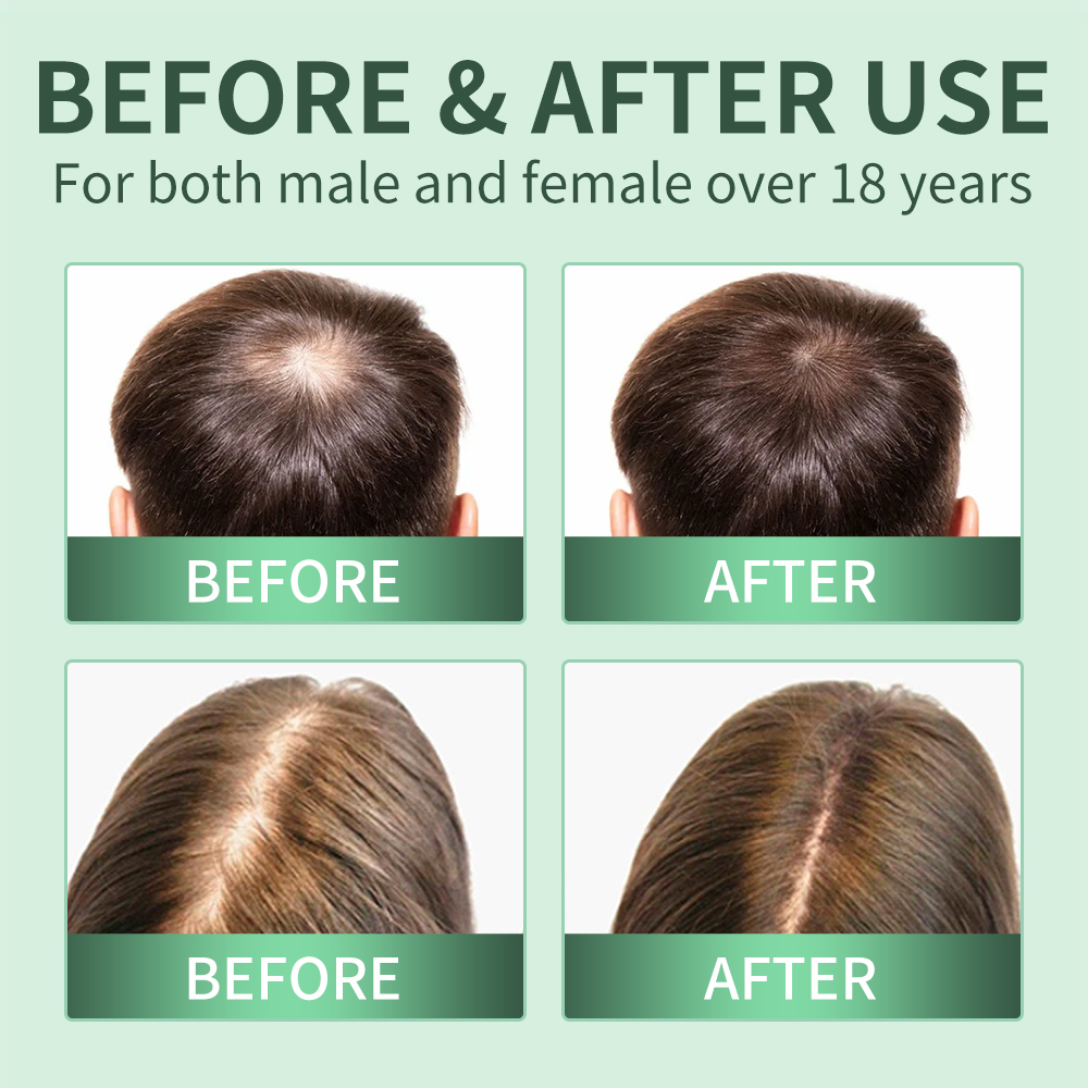Hair Growth Spray,Scalp Scrub, - огляд і ціна Scalp Scrub Exfoliant