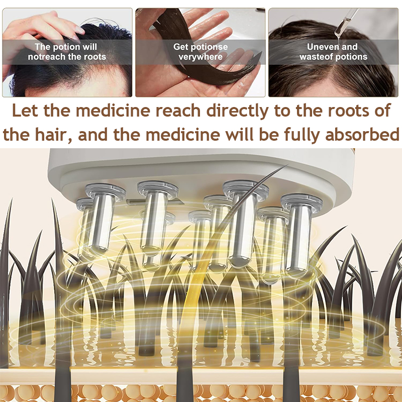 Electric Vibration Scalp Essen - огляд і ціна Hair Care Guide