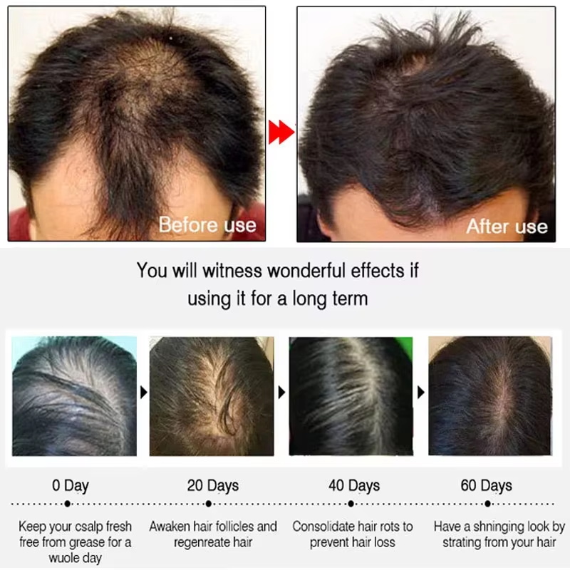 Fast Ginger Hair Growth Spray  - огляд і ціна Hair Care Naturally